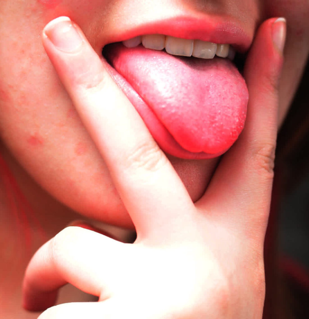 Big tongue